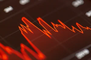 CBI Files Supplementary Chargesheet Against Brokers in NSE Co-location Case
